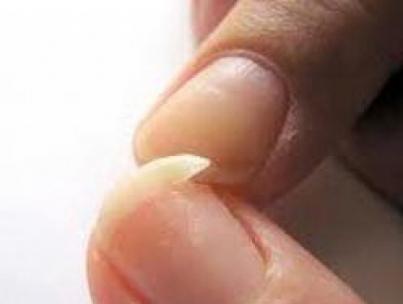 К чему снятся сломанные ногти: толкование